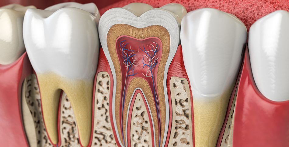 Dental cross-section diagram showing tooth anatomy and root canal treatment procedure illustration.
